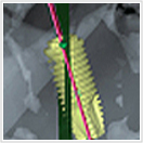 3Dにおける比較画像