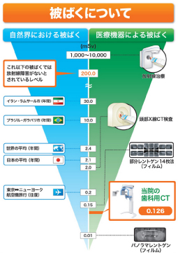 被ばくについて