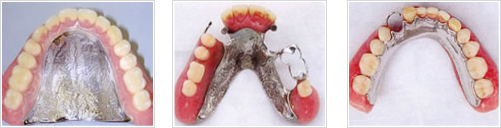 Co-Cr�� ����20���ߡ�