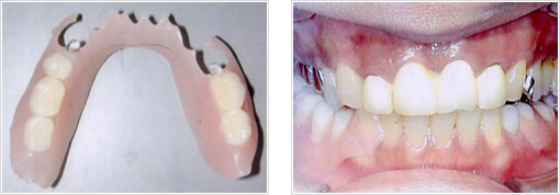 ���������̡�����Τ�Τ�����Ϥ⤢��ޤ�